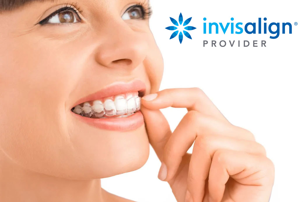 Invisalign logo